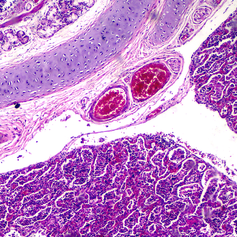 BS-2021B Binocular Biological Microscope