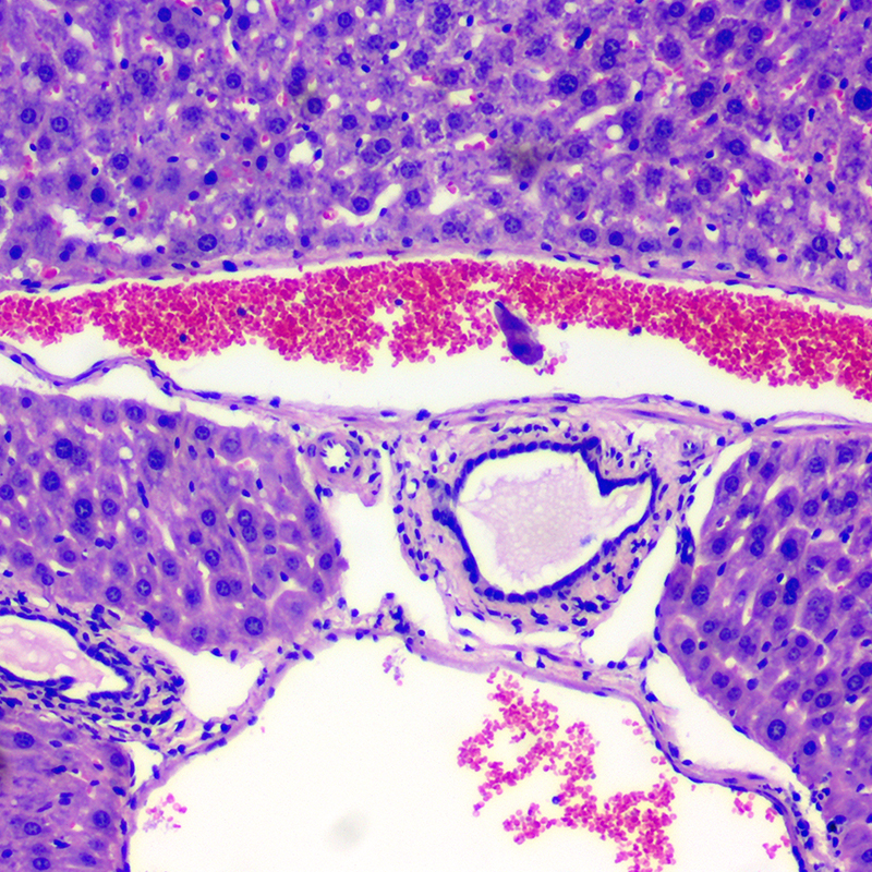 BS-2021B Binocular Biological Microscope