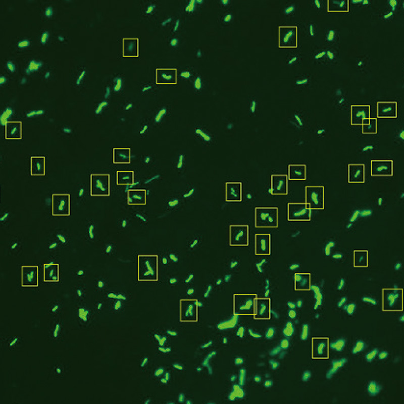 Scanpro 3-200FL Fluorescence Mycobacterium Tuberculosis Microscopy Scanning System