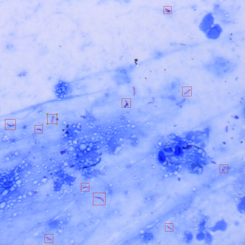 Scanpro 3-200FL Fluorescence Mycobacterium Tuberculosis Microscopy Scanning System