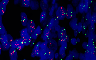 FISH Microscopy Instrument Solution