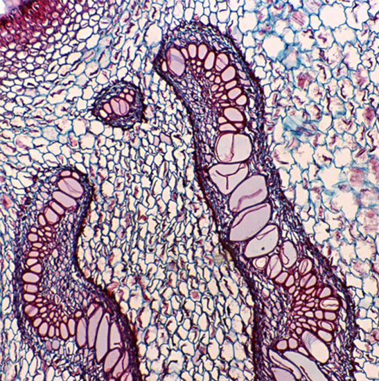BLM4-220 LCD Digital Biological Microscope