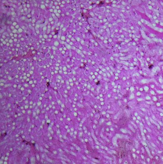 BLM5-254 LCD Digital Biological Microscope