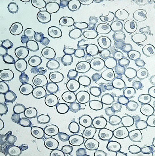 BLM5-293A LCD Digital Inverted Biological Microscope